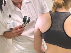 Nemocnice Kyjov odhalila během preventivní akce čtyři melanomy. Kontroly znamének přilákaly stovky lidí